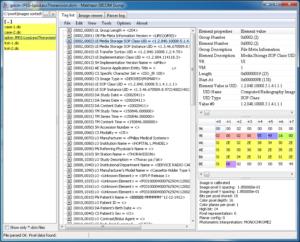  DICOM dump