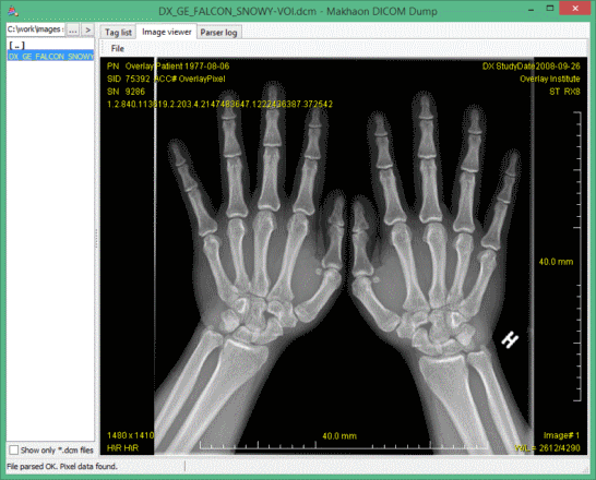 Makhaon DICOM dump image view